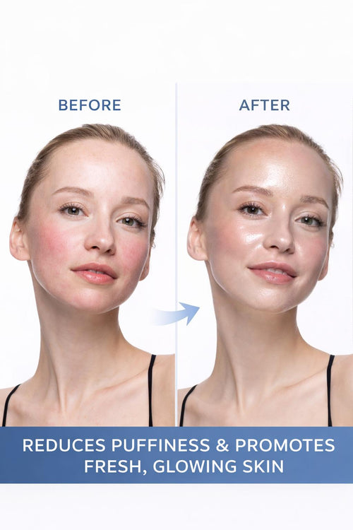 Dermalux Ice Glow Set -De-Puff, Sculpt & Glow Skin